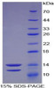 Human Recombinant Peptide YY (PYY)