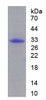 Human Recombinant Tryptase (TPS)