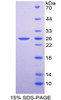 Human Recombinant Superoxide Dismutase 2, Mitochondrial (SOD2)