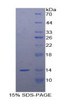 Human Recombinant Galanin (GAL)