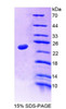 Human Recombinant Nucleoporin 35kDa (NUP35)