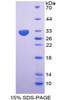 Human Recombinant Nucleoporin 85kDa (NUP85)