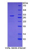 Mouse Recombinant Nucleoporin 107kDa (NUP107)