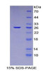 Mouse Recombinant Nucleoporin 133kDa (NUP133)