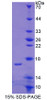 Human Recombinant Cartilage Oligomeric Matrix Protein (COMP)