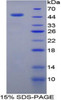 Human Recombinant Retinoblastoma Protein 1 (RB1)