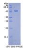 Human Recombinant Plasminogen (Plg)