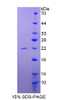 Human Recombinant Tumor Necrosis Factor Receptor Superfamily, Member 5 (TNFRSF5)