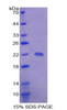 Human Recombinant Down Regulator Of Transcription 1, TBP Binding (DR1)