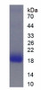 Human Recombinant Membrane Cofactor Protein (MCP)