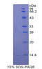 Rat Recombinant Cathepsin D (CTSD)