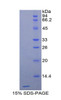 Rat Recombinant Cathepsin D (CTSD)