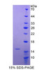 Human Recombinant V-Ha-Ras Harvey Rat Sarcoma Viral Oncogene Homolog (HRAS)