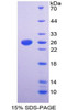 Human Recombinant Glycoprotein V, Platelet (GP5)