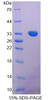 Mouse Recombinant Proopiomelanocortin (POMC)