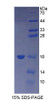 Human Recombinant Thymic Stromal Lymphopoietin (TSLP)