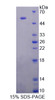 Rat Recombinant Ornithine Decarboxylase (ODC)