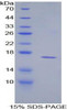Mouse Recombinant Protectin (CD59)