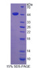 Human Recombinant Actin Gamma 2, Smooth Muscle (ACTg2)