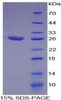 Human Recombinant Activating Transcription Factor 1 (ATF1)