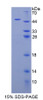 Human Recombinant Adenylate Cyclase Activating Polypeptide 1, Pituitary (ADCYAP1)