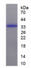 Human Recombinant Arachidonate-5-Lipoxygenase (ALOX5)