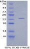 Rat Recombinant Glucokinase Regulatory Protein (GKRP)