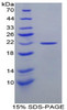 Rat Recombinant Glucokinase Regulatory Protein (GKRP)