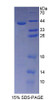 Human Recombinant Cadherin 5 (CDH5)