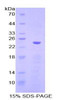 Mouse Recombinant Cadherin 5 (CDH5)