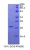 Human Recombinant Gamma-Glutamyltransferase 1 (gGT1)