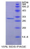 Mouse Recombinant Protein Kinase C Zeta (PKCz)