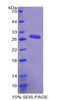 Mouse Recombinant Anoctamin 1 (ANO1)