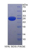 Human Recombinant Platelet Activating Factor Acetylhydrolase Ib3 (PAFAH1B3)