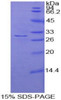 Human Recombinant Adenylate Cyclase 2, Brain (ADCY2)