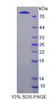 Rat Recombinant Lipopolysaccharide Binding Protein (LBP)