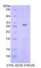 Human Recombinant Adenylate Cyclase 5 (ADCY5)