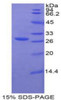 Human Recombinant Glucuronidase Beta (GUSb)