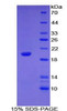 Mouse Recombinant Nucleoporin 210kDa (NUP210)