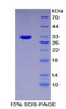 Rat Recombinant Interferon Alpha/Beta Receptor 1 (IFNa/bR1)