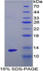 Human Recombinant Enolase, Non Neuronal (NNE)