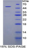 Human Recombinant Enolase, Non Neuronal (NNE)