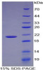 Human Recombinant Enolase, Non Neuronal (NNE)