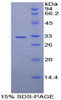 Human Recombinant Amylase Alpha 2, Pancreatic (AMY2)