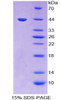 Rabbit Recombinant Matrix Gla Protein (MGP)