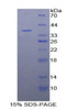 Human Recombinant Mannose Binding Lectin (MBL)