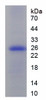 Human Recombinant Ornithine Carbamoyl Transferase (OCT)