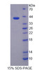 Cattle Recombinant Sorbitol Dehydrogenase (SDH)