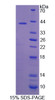 Rat Recombinant Sorbitol Dehydrogenase (SDH)