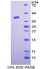 Human Recombinant General Transcription Factor IIE, Polypeptide 1 (GTF2E1)
